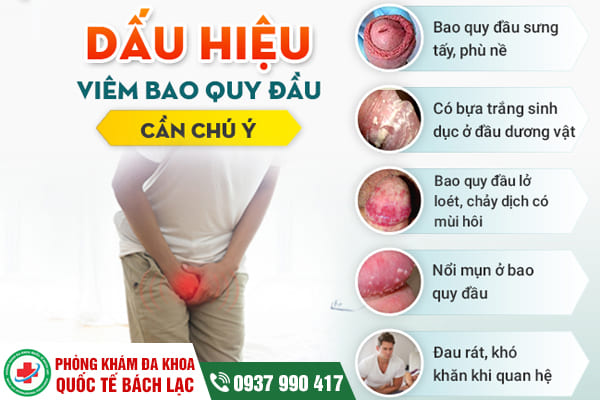 5 dấu hiệu viêm bao quy đầu điển hình ở nam giới