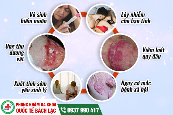 5 dấu hiệu viêm bao quy đầu điển hình ở nam giới
