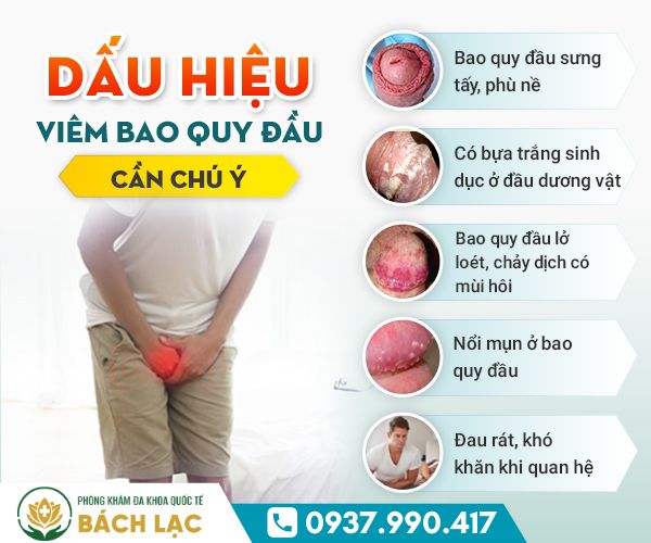 Dấu Hiệu Viêm Bao Quy Đầu Ở Nam Giới Cần Lưu Ý