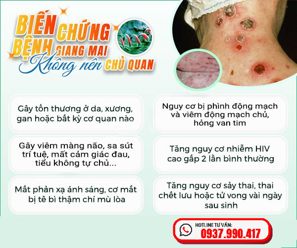 Tác hại khi không Chữa Bệnh Giang Mai Ở Buôn Ma Thuột kịp thời