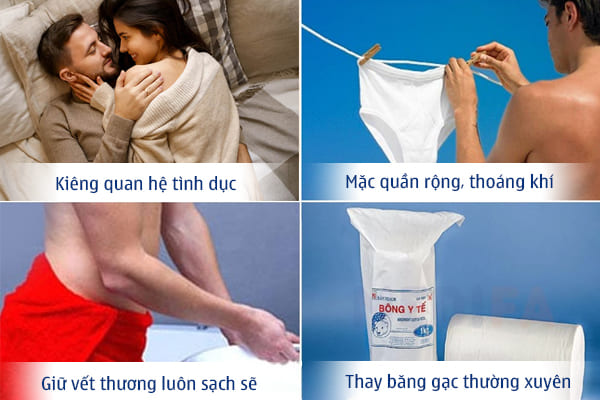 Cắt bao quy đầu bao lâu thì lành - Chuyên gia giải đáp chi tiết