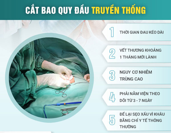 Cắt bao quy đầu truyền thống