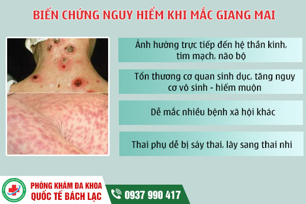 Phòng khám chữa bệnh giang mai ở Buôn Ma Thuột hiệu quả, uy tín