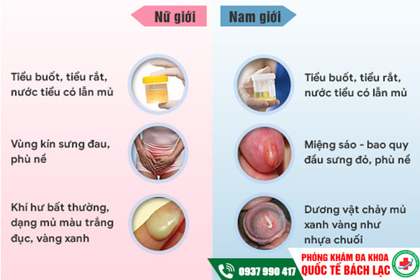 Dấu hiệu bệnh lậu dễ nhận biết ở nam và nữ giới