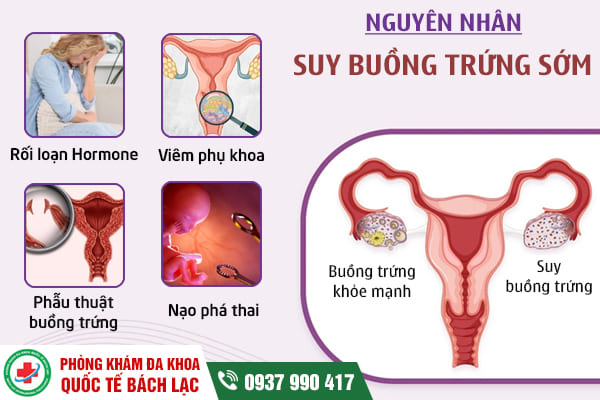 5 dấu hiệu suy buồng trứng sớm nữ giới không nên bỏ qua