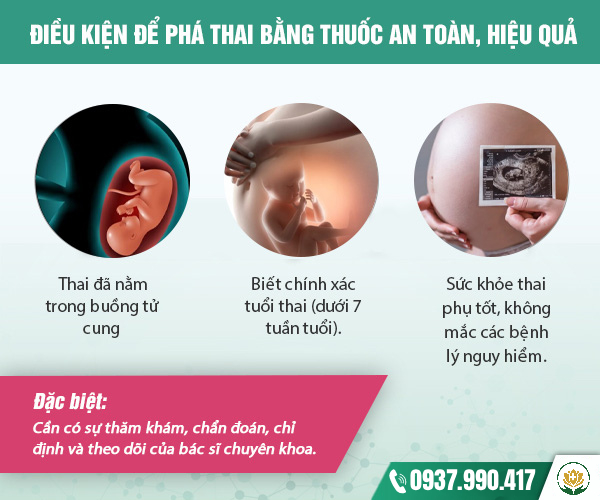 Điều kiện để phá thai bằng thuốc an toàn