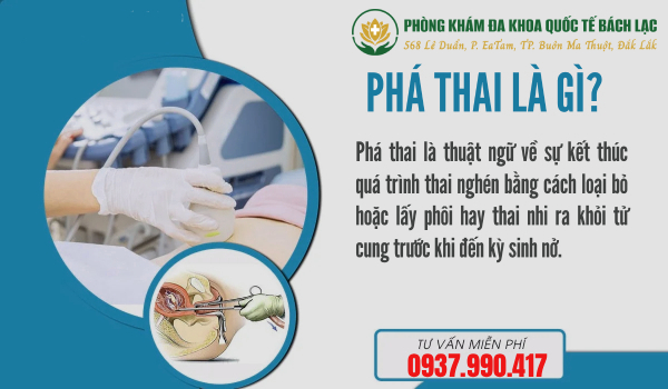 Phá thai là gì?