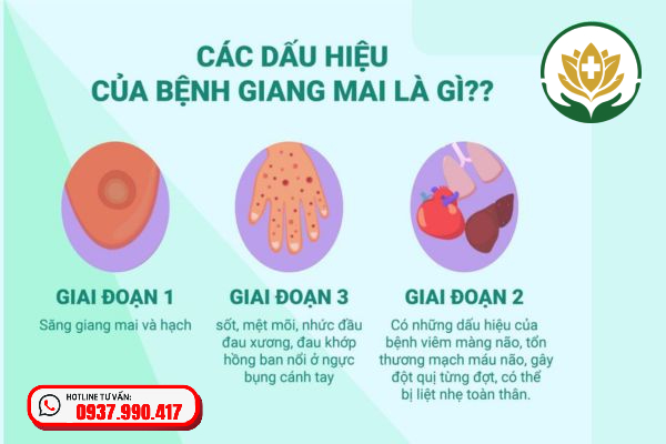 Triệu chứng bệnh giang mai qua các giai đoạn