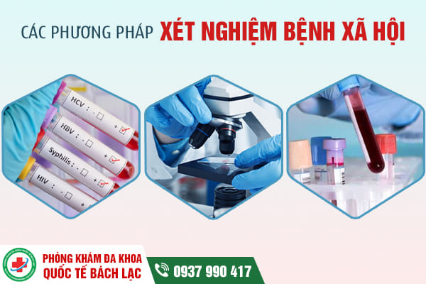 Địa chỉ xét nghiệm bệnh xã hội ở Buôn Ma Thuột nhanh, chính xác