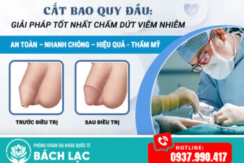 Địa Chỉ Khám Viêm Bao Quy Đầu Đắk Lắk Cơ Sở Nào Uy Tín? Khám Viêm Bao Quy Đầu Ở Đâu Chất Lượng?