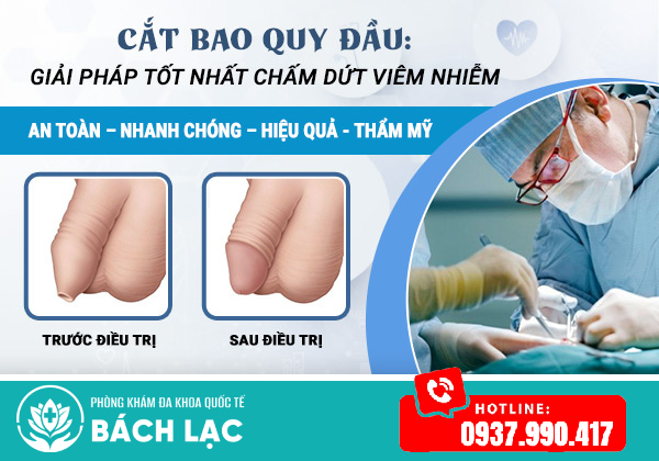 Chữa viêm bao quy đầu bằng phương pháp cắt bao quy đầu