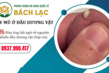 Khám Dương Vật Chảy Mủ Đắk Lắk Ở Đâu Uy Tín, An Toàn Và Đạt Hiệu Quả Chữa Trị Cao?