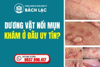 Nam Giới Bị Dương Vật Nổi Mụn Khám Ở Đâu Đắk Lắk? Địa Chỉ Khám Chữa Nam Khoa Đắk Lắk Tốt Nhất Hiện Nay