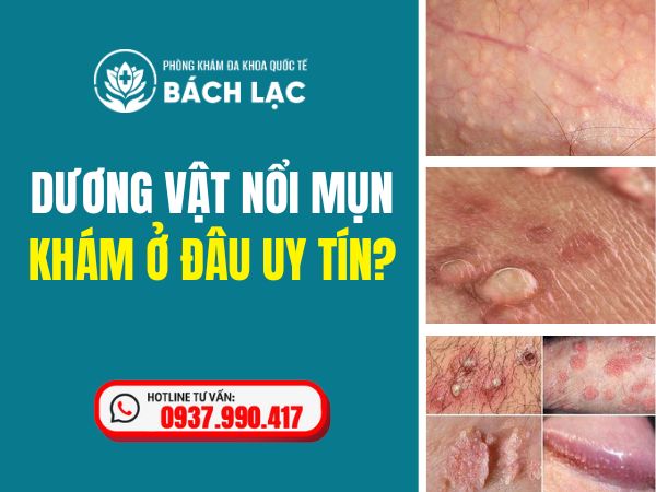 Nam Giới Bị Dương Vật Nổi Mụn Khám Ở Đâu Đắk Lắk? Địa Chỉ Khám Chữa Nam Khoa Đắk Lắk Tốt Nhất Hiện Nay