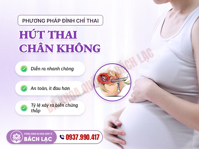Phương pháp đình chỉ thai hút thai chân không
