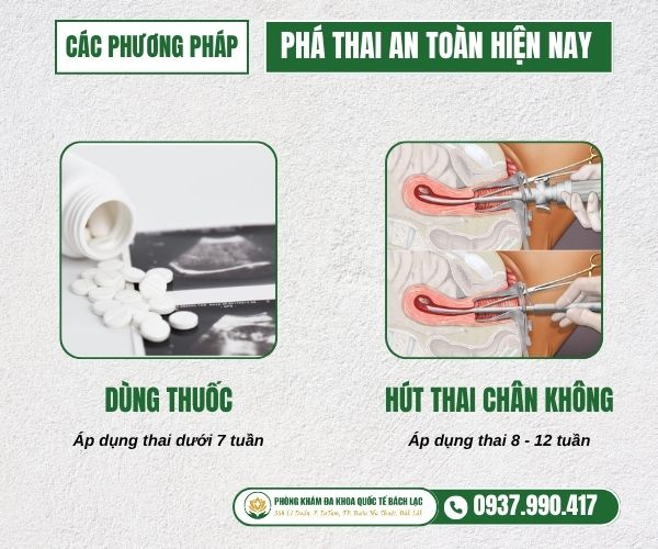 Phương pháp phá thai đa dạng, an toàn và ít đau