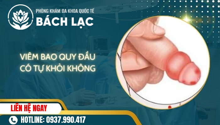 Viêm Bao Quy Đầu Có Tự Khỏi Được Không?