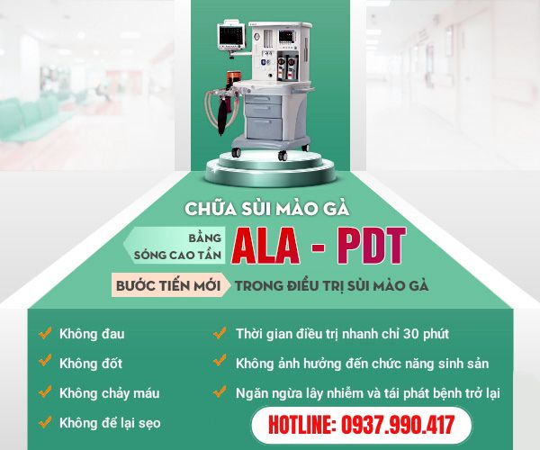 Phương pháp điều trị sùi mào gà hiện đại
