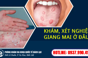 Top 5 Địa Chỉ Chữa Giang Mai Ở Đắk Lắk Uy Tín Và An Toàn Năm 2025