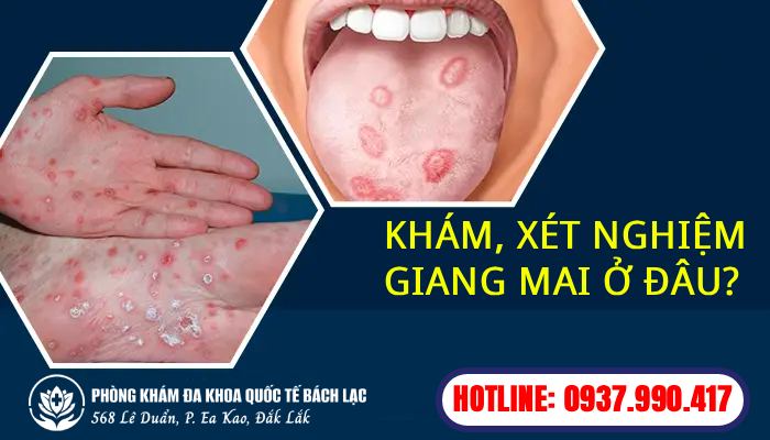 Địa Chỉ Chữa Giang Mai Ở Đắk Lắk Uy Tín Và An Toàn