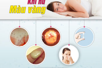 Khí Hư Màu Vàng Là Dấu Hiệu Bệnh Phụ Khoa Nào? Khám Khí Hư Màu Vàng Ở Đâu Đắk Lắk?