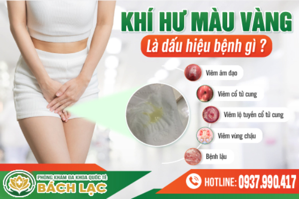 Nguyên nhân khí hư màu vàng