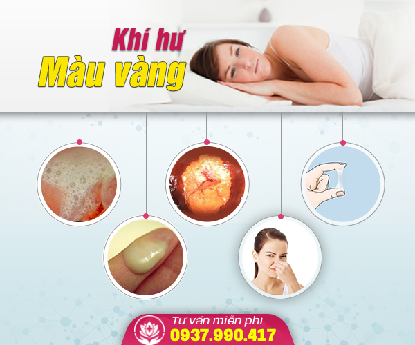 Khí Hư Màu Vàng Là Dấu Hiệu Bệnh Phụ Khoa Nào?