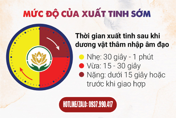 3 Mức độ của xuất tinh sớm