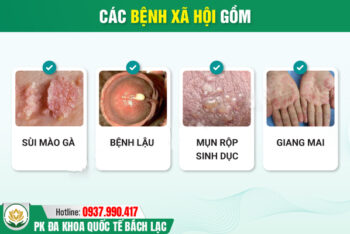 Bệnh Xã Hội Là Gì? 5 Bệnh Xã Hội Thường Gặp Hiện Nay, Cảnh Báo Biến Chứng Nguy Hiểm
