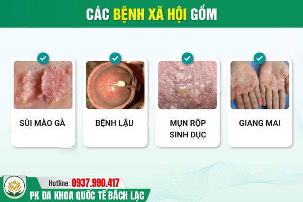 Bệnh lây truyền qua đường tình dục