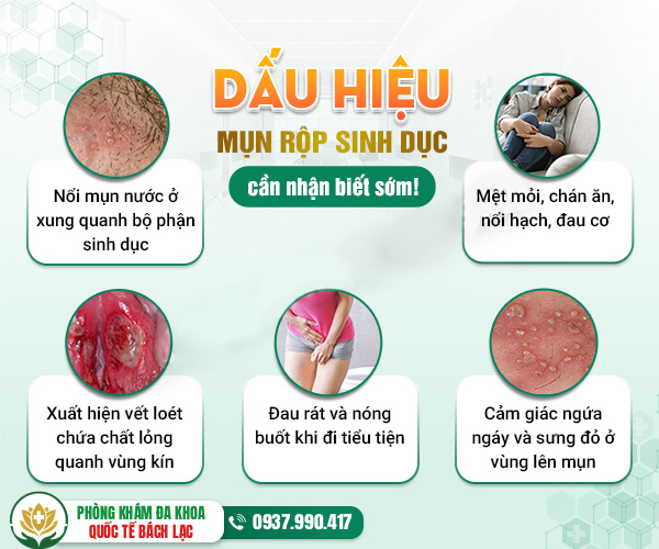 Dấu hiệu mụn rộp sinh dục