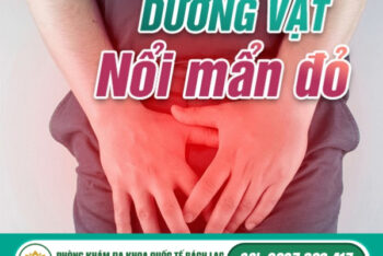 Đầu Dương Vật Nổi Mẩn Đỏ Dấu Hiệu Cảnh Báo Bệnh Gì? Khám Đầu Dương Vật Nổi Mẩn Đỏ Ở Đâu Đắk Lắk?