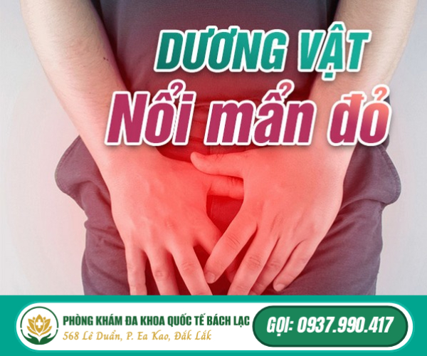 Đầu Dương Vật Nổi Mẩn Đỏ Dấu Hiệu Cảnh Báo Bệnh Gì?