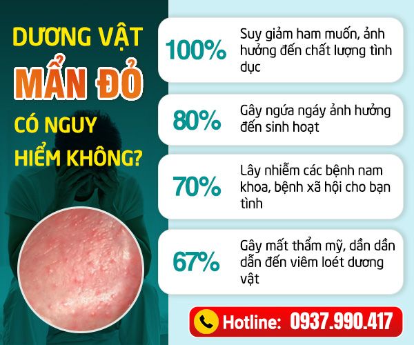 Đầu dương vật nổi mẩn đỏ ở nam giới có sao không?