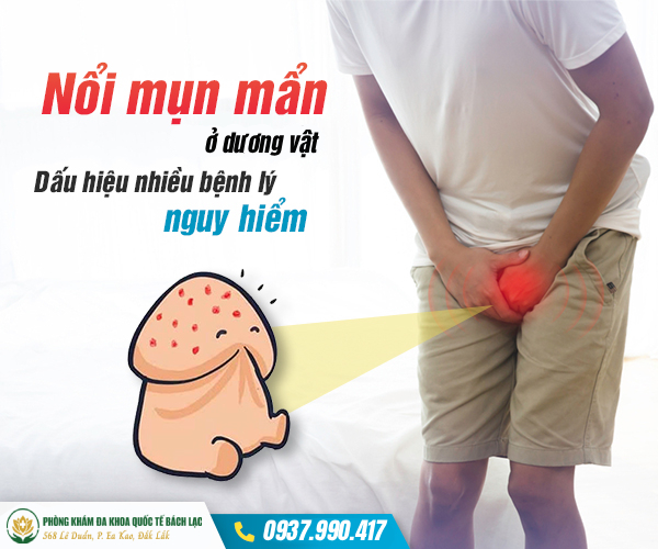 Nam giới bị đầu dương vật nổi mẩn đỏ là gì?