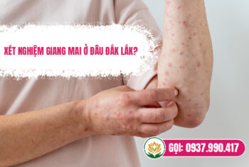 Phòng Khám Xét Nghiệm Giang Mai Ở Đắk Lắk Được Đánh Giá Cao 2025